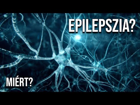 MIÉRT? Epilepsziás valaki? Mi az az epilepszia?