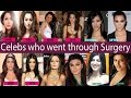 7 celebrities who have confessed to going under the knife  newspointtv