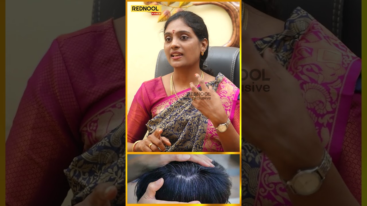 நம்ம Scalp-ல Blood Circulation நல்லா இருக்கணும் | Dr Nithya 