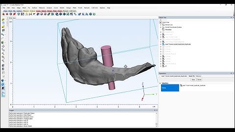 Surgical guide planning from model materialase 3matic lesson 6