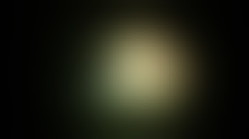 Glass IOFB removal by John B. Miller