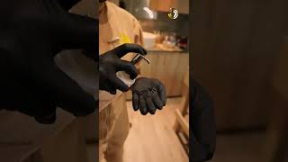 Underarm Peel 2nd Session | Yashodha Wimaladharma @ 360 Aesthetics 🌸✨