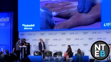Man Gets Live Microchip Implant At Technology Conference In Barcelona Spain