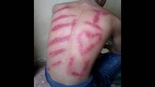 [247] Perang Bersama Bot di Malam Hari