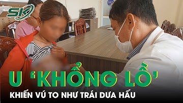 Cắt bỏ khối u vú to như trái dưa hấu cho bệnh nhân Campuchia | SKĐS