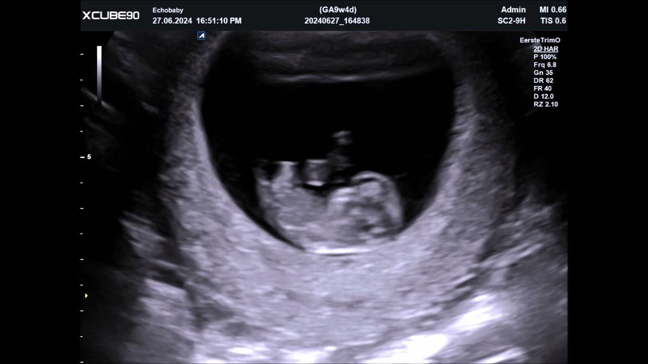 Pretecho 9 Weken Foto's en Filmpjes