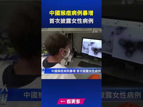 中国猴痘病例暴增 首次披露女性病例