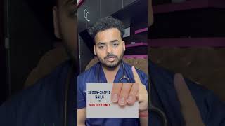 Your nails tell about your health. shorts#doctor#medico#facts#education