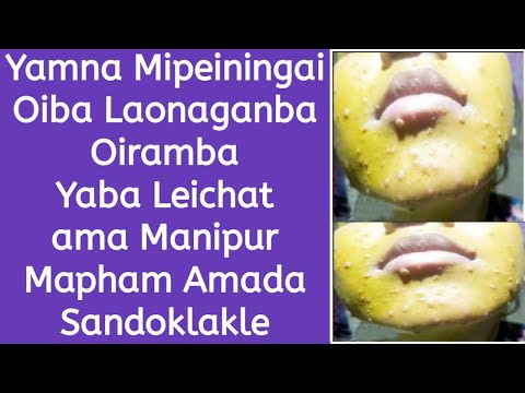 Yamna Mipeiningai Oiba Laonaganba Oiramba Yaba Leichat ama Manipur Mapham Amada Sandoklakle