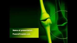 Joint Picture PowerPoint Template by PoweredTemplate.com