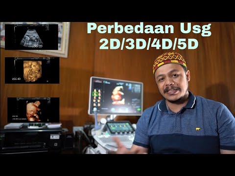 Video: Perbedaan Antara Sonogram Dan Ultrasound