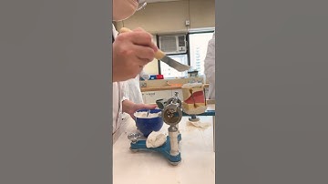 #mounting #articulator #dentatus # lower #mandibular #completedenture