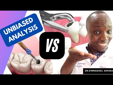 Extraction Vs Root Canal(Which is Better?)| Unbiased Opinion