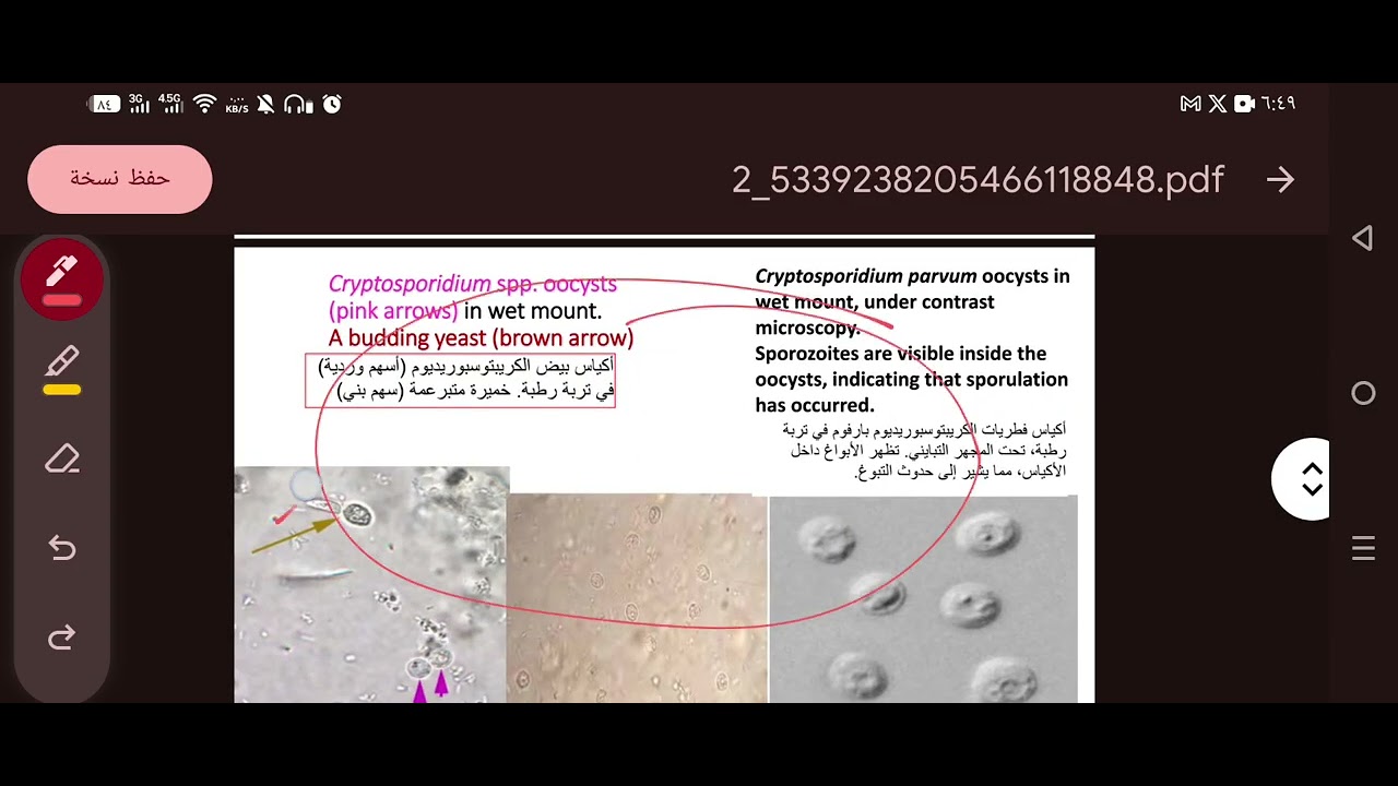 طفيليات عملي 5+6