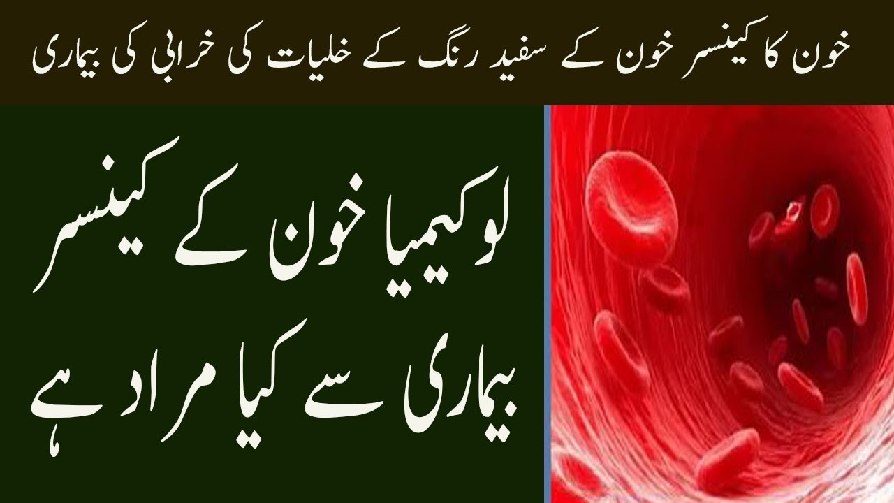 What Is Leukemia Blood Cancer In Urdu Leukemia Khoon Ka Cancer Sartan