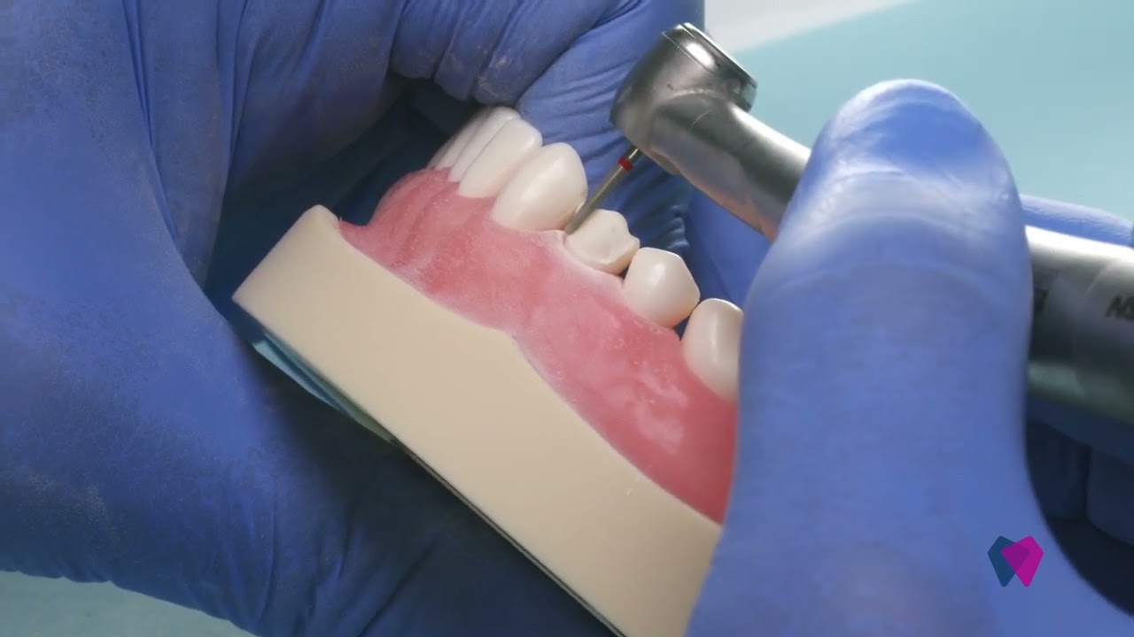 Your Lab Can Tell When You Half-Prep a Margin — Don’t Be That Dentist