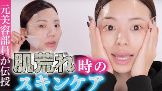 【肌トラブル時のスキンケア】ニキビに保湿は必要？ガチ愛用品紹介！スキンケアルーティーン