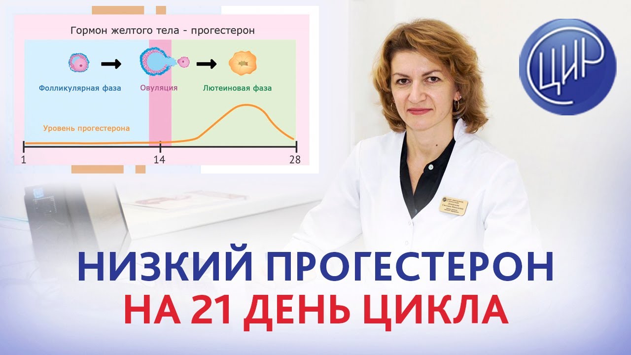 Гормональные анализы на 21 день цикла: прогестерон 1,7, эстрадиол 283. Что это значит и что делать?