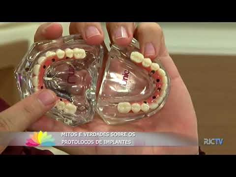 Mitos e verdades sobre os protocolos de implantes