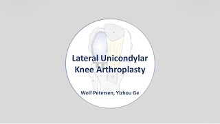 Lateral Unicondylar Knee Arthroplasty 