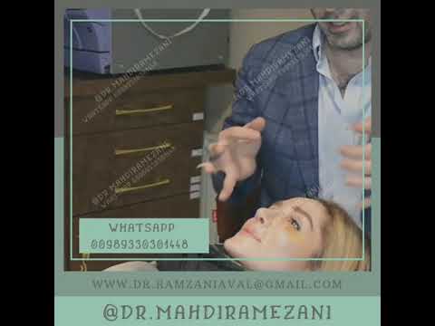 عملية تجمیل الانف و عملیة شد و الوجة و الجسم بدون وسطاء مع فوق تخصص دكتور مهدی رمضانی ايران مشهد