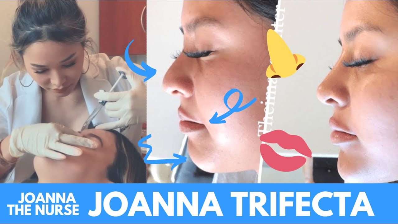 THE JOANNA TRIFECTA (plus a little Botox)! | Joanna the Nurse