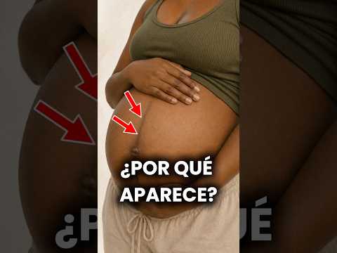 La misteriosa línea oscura que aparece en la barriga durante el embarazo. #dermatologia #dermatologo