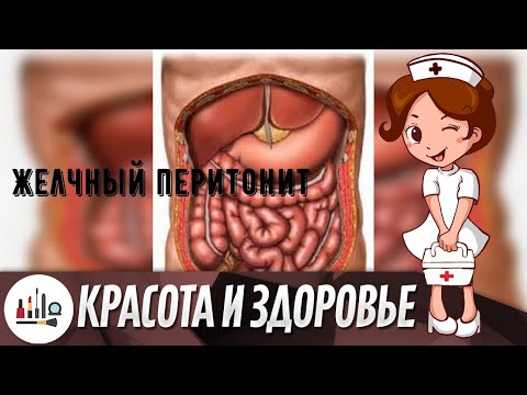 Желчный перитонит