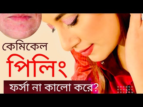 ভিডিও: সাধারণ পিলিং সলিউশন কি বন্ধ করা হয়েছে?