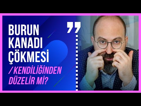 Burun kanadı çökmesi / kendiliğinden düzelir mi?