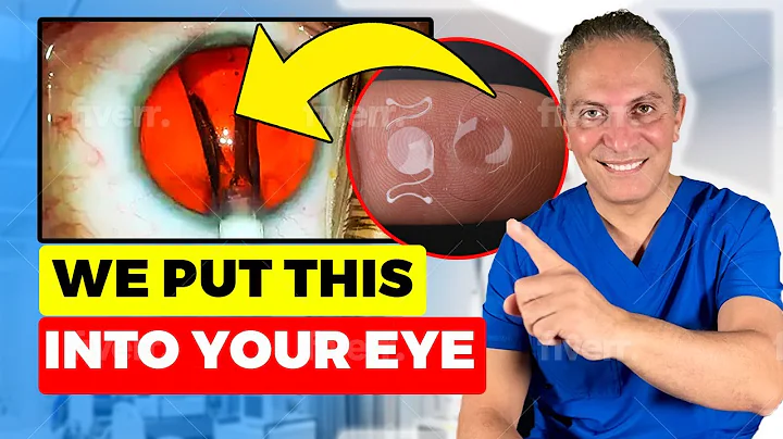 How Does The EVO ICL Surgery Work? | EVO ICL Explained