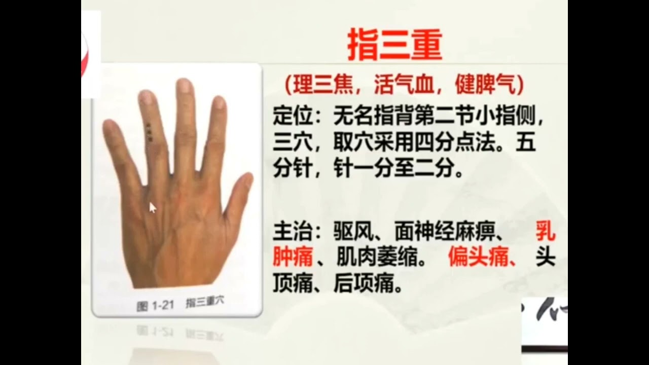 7.9 指三重乳腺病| 董氏奇穴, 林君, Master Tung Acupuncture Points