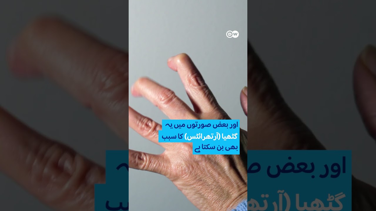 Do you have thumb pain because of scrolling on the smartphone? | Hum News | Pakistan