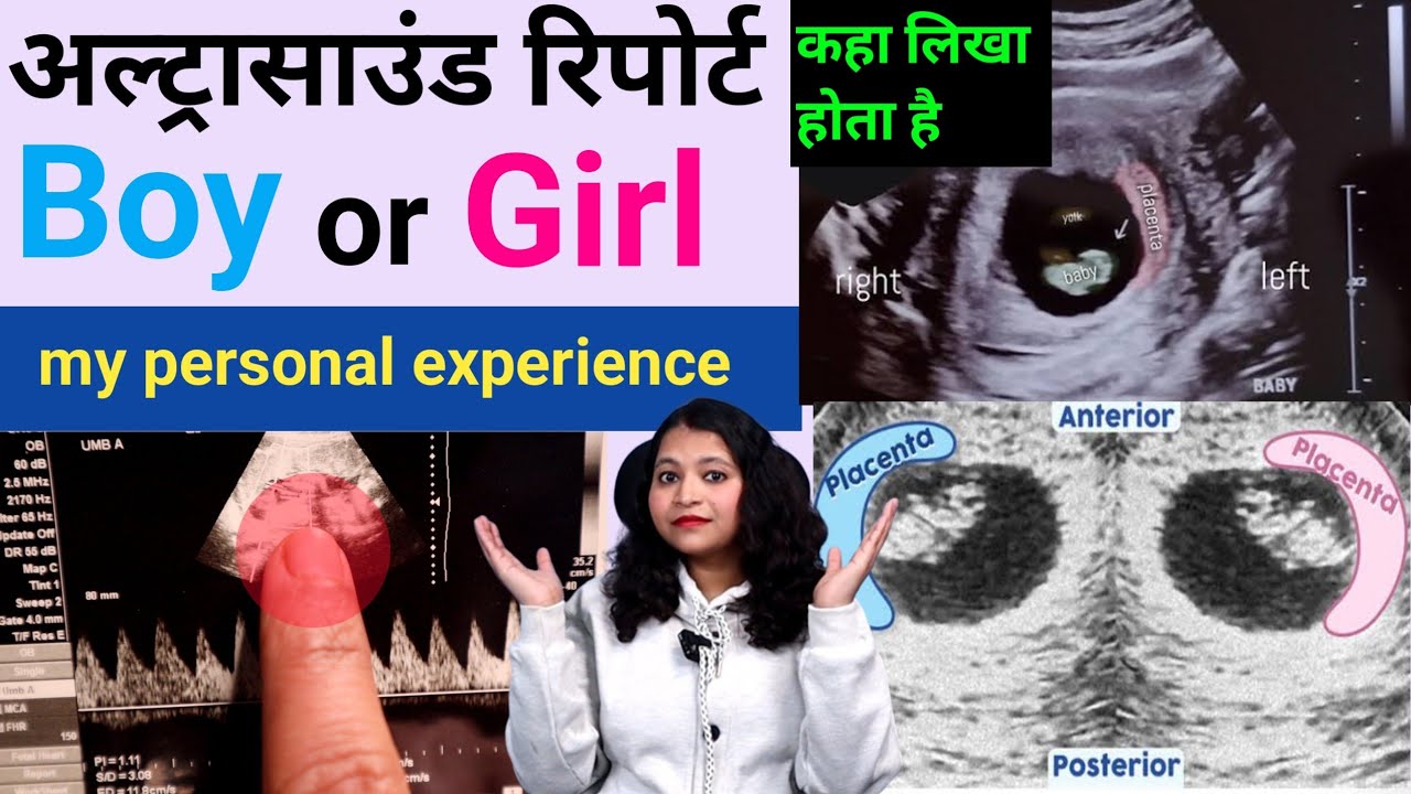 अल्ट्रासाउंड में लड़के की पहचान क्या है?Boy Or Girl in pregnancy?Ultrasound report Boy Or Girl?