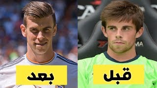 شاهد 12 لاعب كرة القدم قبل وبعد اجراء عمليات التجميل..!!