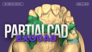 exocad partialcad diseño de estructura  con aditamento / structure design with attachment