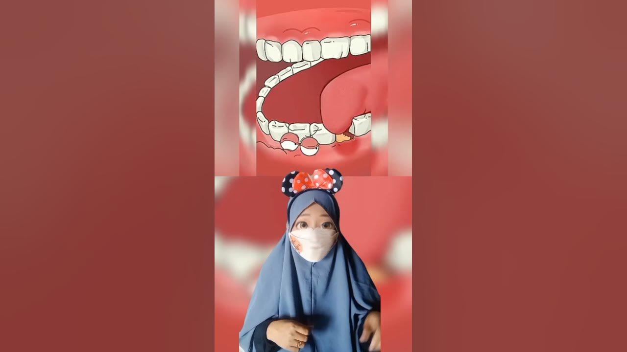 Pipi Bengkak Karena Sakit Gigi |Mv #shorts - YouTube