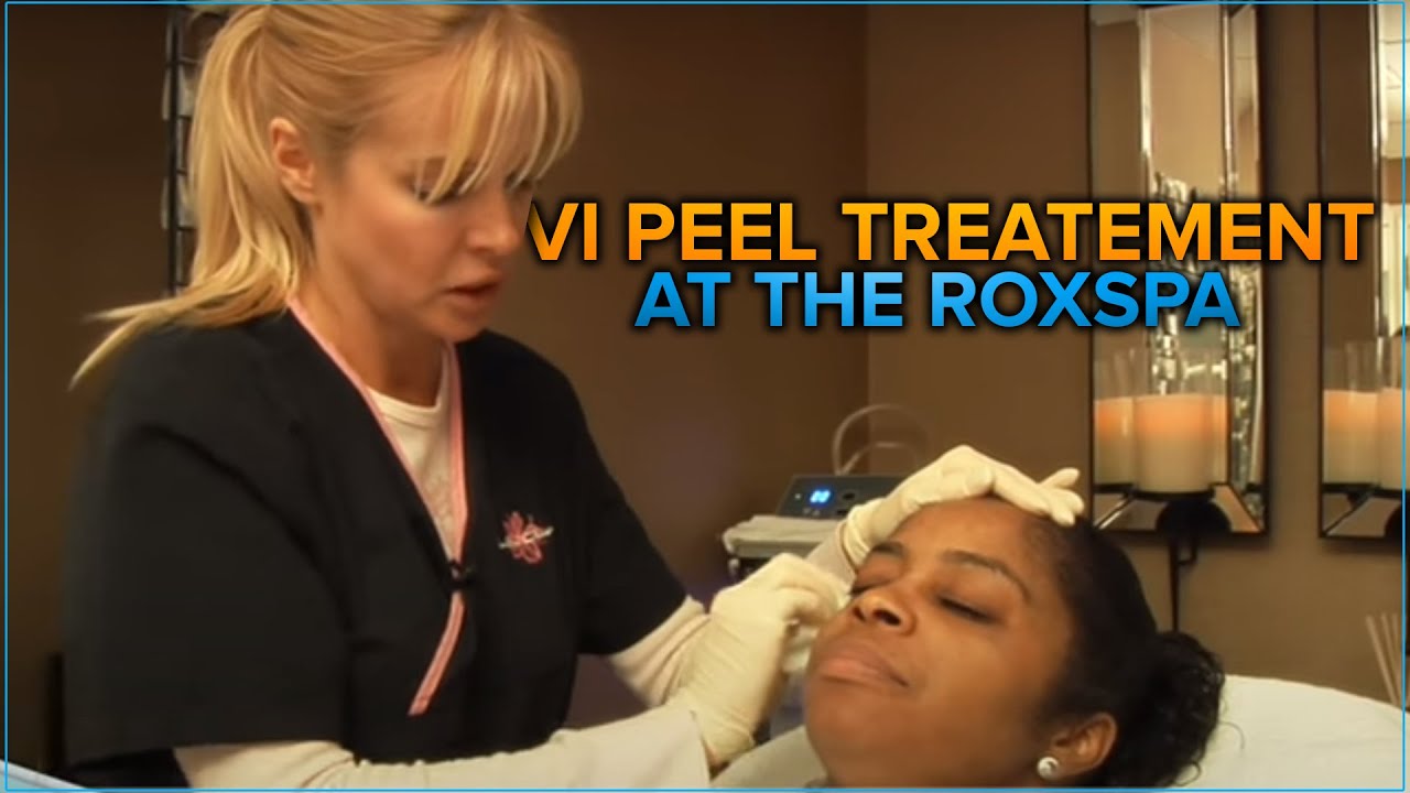 Vi Peel Treatment at the RoxSpa