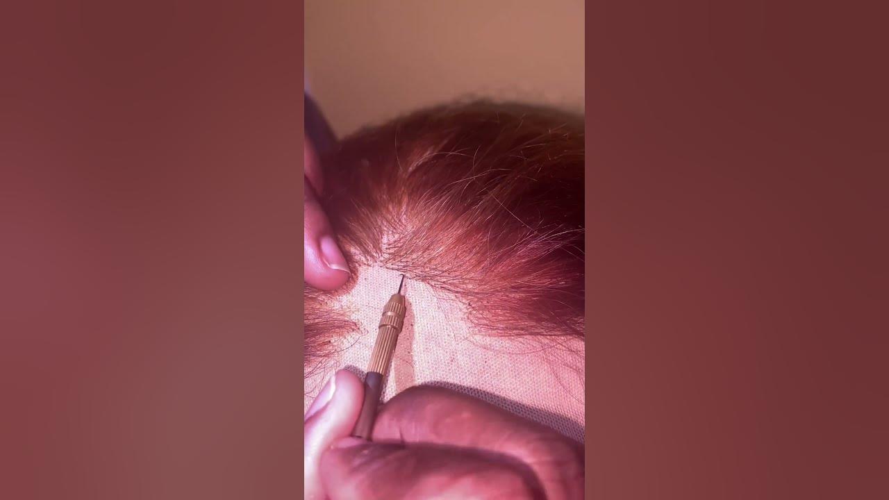 HOW TO FIX A BALD SPOT IN YOUR LACE CLOSURE/FRONTAL WIG