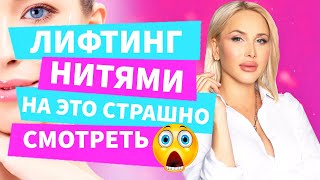 Лифтинг нитями | Подтяжка лица | Процесс введения нитей