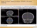 OsiriX for Neurosurgeons and Craniofacial surgeons