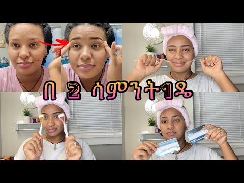 ቪዲዮ: የቅንድብ ፀጉር ለምን ነጭ ይሆናል?