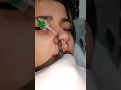 طريقه تركيب حلق الانف
