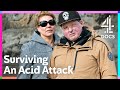 Love Wins After Brutal Acid Attack | Love Against The Odds | Channel 4 Documentaries