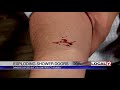 The dangers of exploding glass shower doors The dangers of exploding glass shower doors