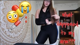 What happened to my arm??? // All About My Injury