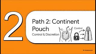 Urinary Diversion Options
