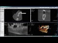 Ekram Dental Imaging Center, Demo on CBCT viewer , CBCT interpretation + Nerve Tracing, Khaled Ekram