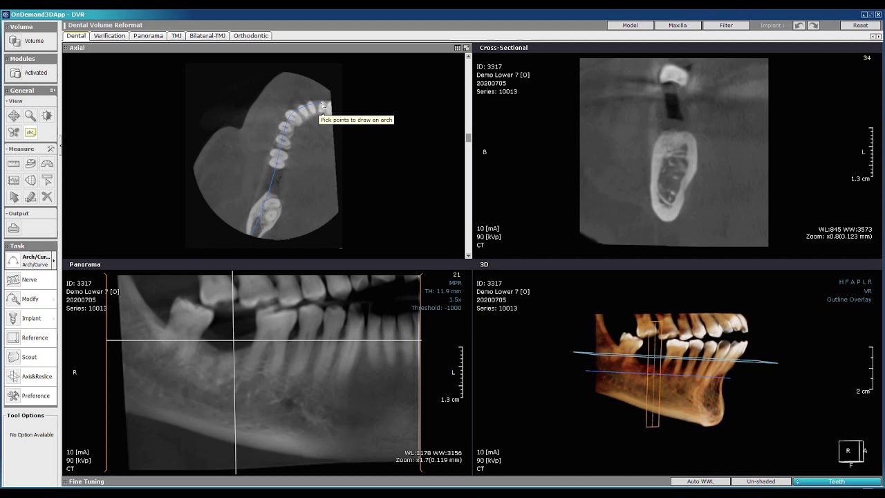 Ekram Dental Imaging Center, Demo on CBCT viewer , CBCT interpretation