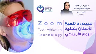 تبييض و تلميع الأسنان بتقنية الزوم الأمريكي Zoom Teeth whitening Technology